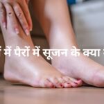 महिलाओं में पैरों में सूजन के क्या कारण हैं?