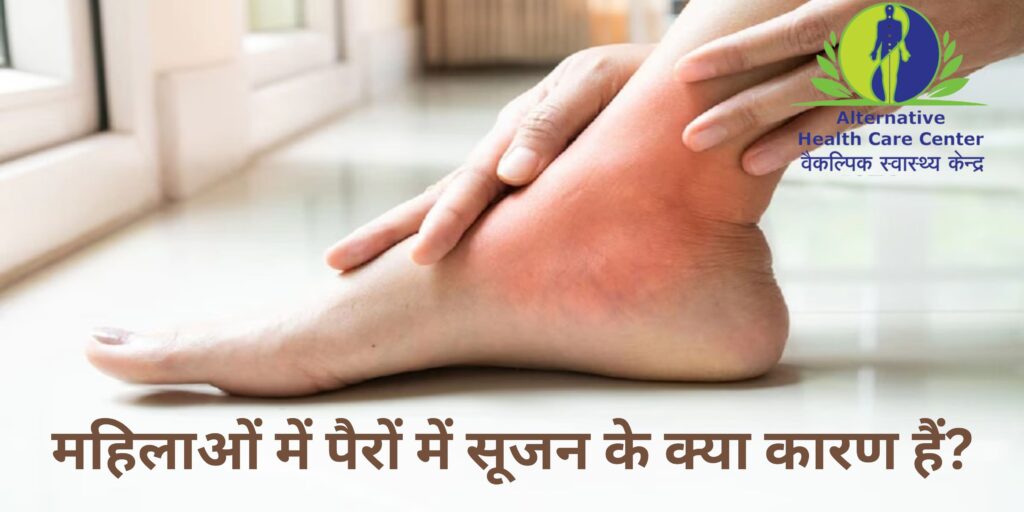 महिलाओं में पैरों में सूजन के क्या कारण हैं?
